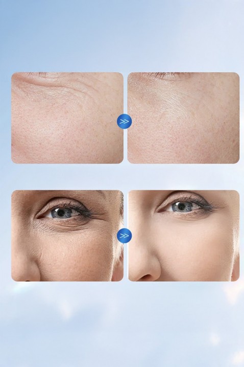 Ampule za lice SADOER Hyaluronic AcidIVET.HR - MODERNA ODJEĆA