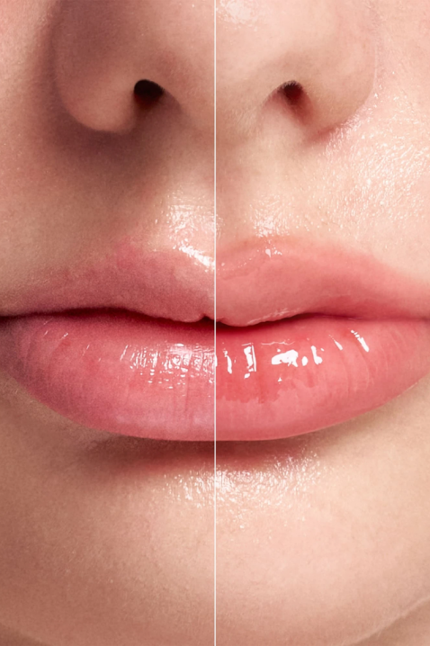 Intense lip plumper with microneedles Reedle Shot Lip Plumper Expert, 4,3 gIVET.HR - MODERNA ODJEĆA